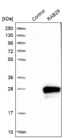 RAB7L1 Antibody, Novus Biologicals:Antibodies:Primary Antibodies